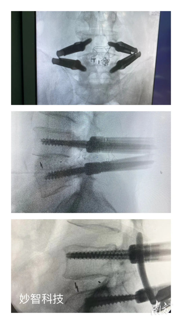 1683696215235599.png ad1d5fd4240d4e6083c231d15c94ea3d_batchwm.png